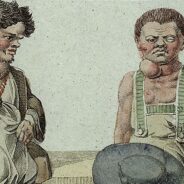 Swiss medical breakthrough in curing cretinism